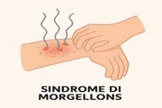 sindrome di Morgellons